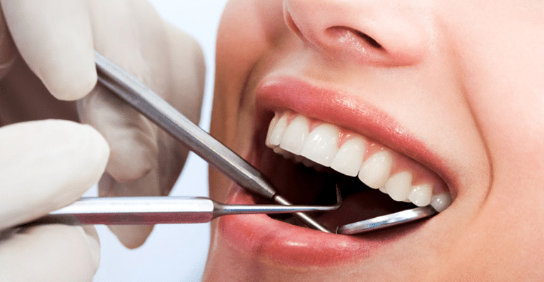 7 Easy Facts About Dental Check Up Shown