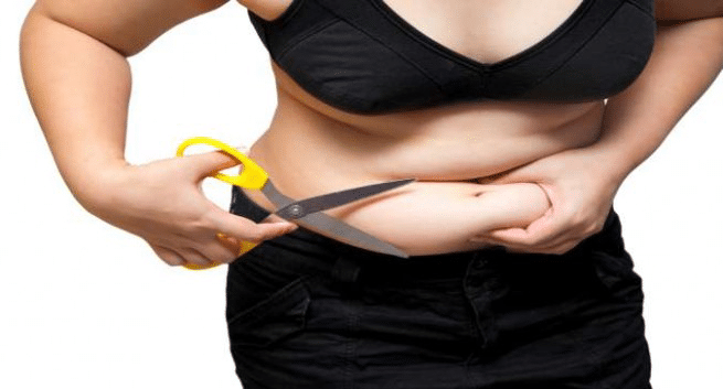 Weight Loss Surgery – Things You Should Consider Before Going Under The Knife