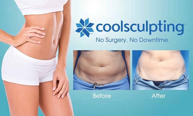 Coolsculpting- Getting Your Hourglass Figure Is Not A Dream Anymore