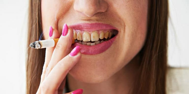 How Smoking Can Lead To Gum Diseases