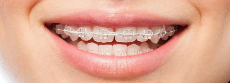 Tips From An Expert Orthodontiste To Get The Most Out Of Your Orthodontic Treatment