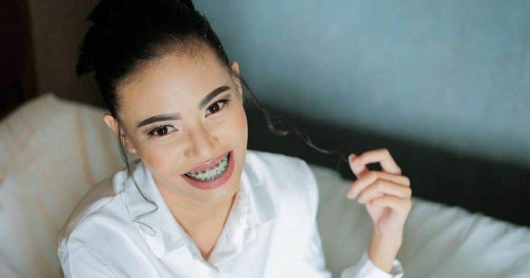 Adult Dental Braces – 9 Reasons Why You Should Consider It